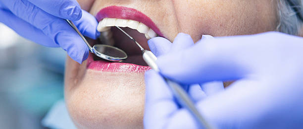 Best Emergency Dental Care for Broken or Chipped Teeth in Kamiah, ID